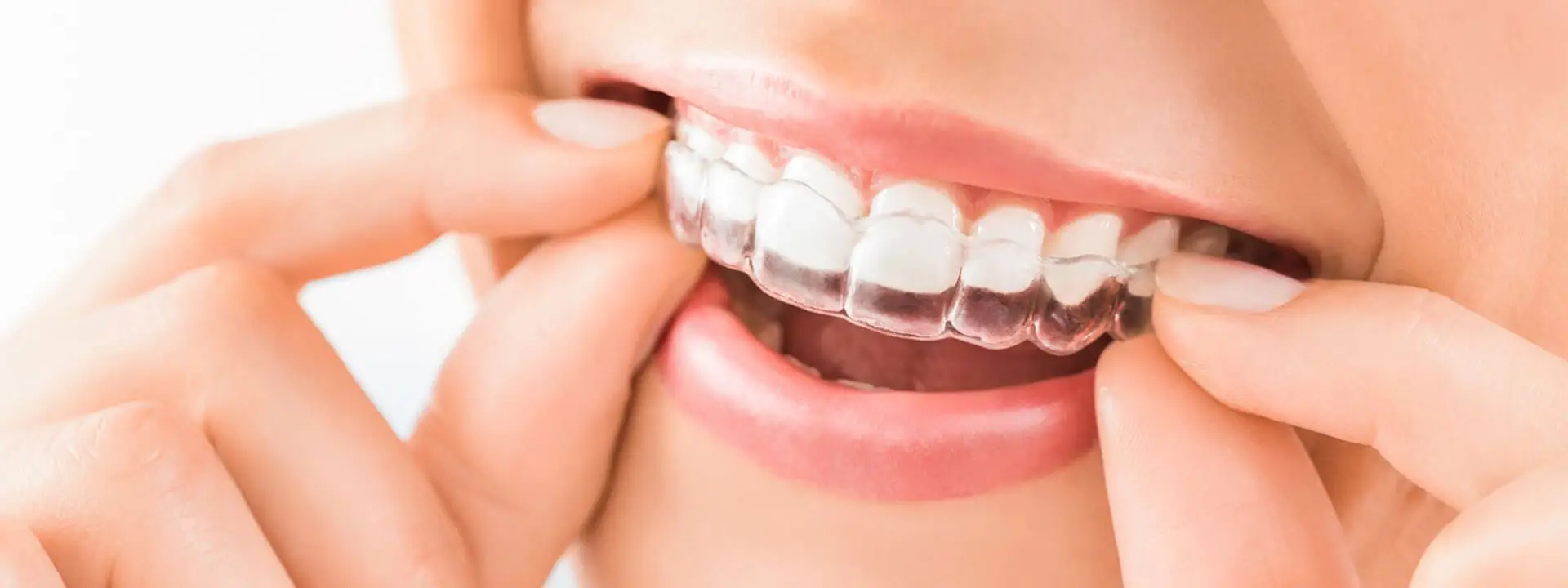 Select Care Dental Select Care Dental